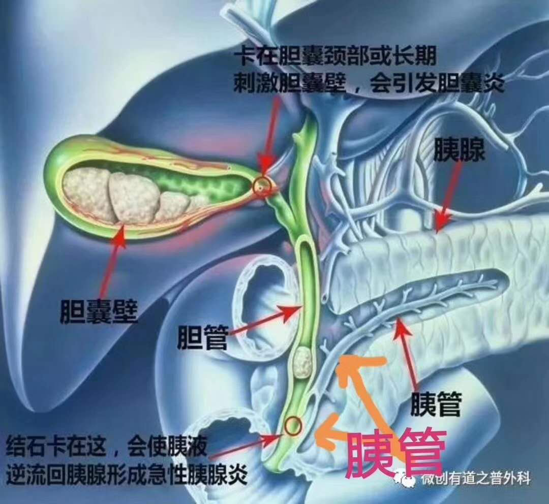 肠道壁增厚CT表现_肠壁